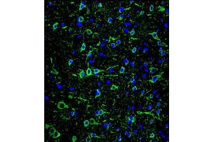 Confocal immunofluorescent analysis of P2 Antibody ABIN659033 with brain tissue followed by Alexa Fluor® 488-conjugated goat anti-mouse lgG (green). (MAP2 抗体)