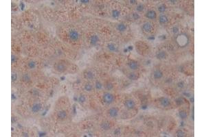 Immunohistochemistry (IHC) image for anti-Nucleoredoxin (NXN) (AA 166-327) antibody (ABIN7436471)