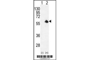 Western blot analysis of CDK8 using rabbit polyclonal CDK8 Antibody using 293 cell lysates (2 ug/lane) either nontransfected (Lane 1) or transiently transfected (Lane 2) with the CDK8 gene. (CDK8 抗体  (AA 249-277))