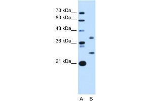 WB Suggested Anti-ST8SIA2 Antibody Titration:  1 ug/ml  Positive Control:  HepG2 cell lysate (ST8SIA2 抗体  (C-Term))