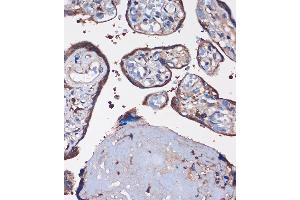 Immunohistochemistry of paraffin-embedded Human placenta using WDR61 Rabbit pAb (ABIN7271361) at dilution of 1:100 (40x lens). (WDR61 抗体  (AA 1-305))