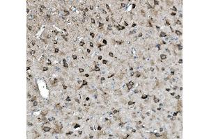 IHC analysis of Glutaminase/GLS using anti-Glutaminase/GLS antibody (ABIN7601603).