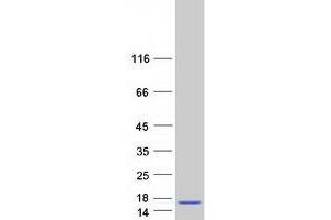 Western Blotting (WB) image for Gonadotropin-Releasing Hormone 1 (Luteinizing-Releasing Hormone) (GNRH1) (Transcript Variant 2) protein (Myc-DYKDDDDK Tag) (ABIN2722115)