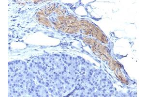 Formalin-fixed, paraffin-embedded human Pancreas stained with CD56 Mouse Monoclonal Antibody (NCAM1/795). (CD56 抗体)