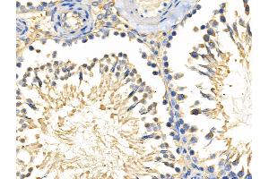 ABIN6258875 and ABIN6274225 at 1/100 staining Rat testis tissue by IHC-P. (LTK 抗体  (Internal Region))