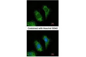 ICC/IF Image Immunofluorescence analysis of methanol-fixed HeLa, using TRAF5, antibody at 1:200 dilution.