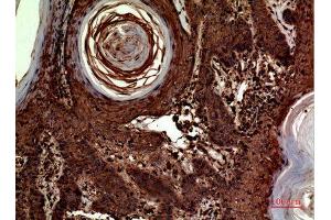 Immunohistochemistry (IHC) analysis of paraffin-embedded Human Skin, antibody was diluted at 1:100. (INHBA 抗体  (C-Term))