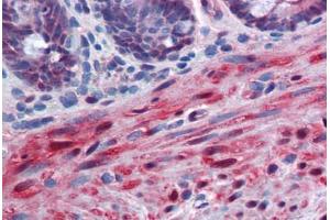Human Colon, muscularis mucosa: Formalin-Fixed, Paraffin-Embedded (FFPE) (YAP1 抗体  (AA 53-162))