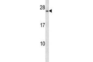 CD79a antibody western blot analysis in CEM lysate.