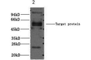 Western Blotting (WB) image for anti-Fc Fragment of IgE, Low Affinity II, Receptor For (CD23) (FCER2) antibody (ABIN5960827) (FCER2 抗体)