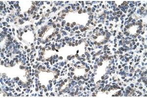 Immunohistochemical staining (Formalin-fixed paraffin-embedded sections) of human lung with KCTD6 polyclonal antibody . (KCTD6 抗体  (AA 32-70))