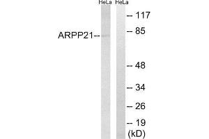 Western Blotting (WB) image for anti-cAMP-Regulated phosphoprotein, 21kDa (ARPP21) (Internal Region) antibody (ABIN1850975) (ARPP21 抗体  (Internal Region))