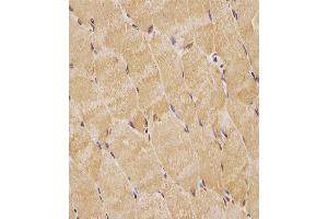 (ABIN6244021 and ABIN6578763) staining TK1 in human skeletal muscle tissue sections by Immunohistochemistry (IHC-P - paraformaldehyde-fixed, paraffin-embedded sections). (TK1 抗体  (AA 139-173))