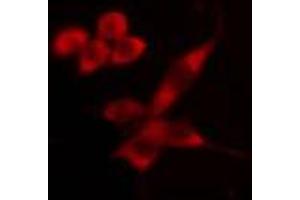 ABIN6274493 staining HeLa cells by IF/ICC. (MKNK1 抗体  (Internal Region))