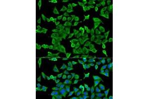 Immunofluorescence analysis of U2OS cells using ACTR2 Polyclonal Antibody (ACTR2 抗体)