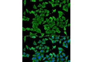 Immunofluorescence analysis of U2OS cells using ACTR2 Polyclonal Antibody (ACTR2 抗体)