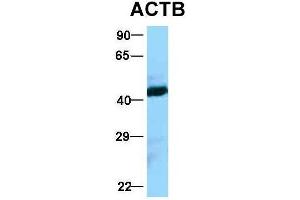 Western Blotting (WB) image for anti-Actin, beta (ACTB) (Middle Region) antibody (ABIN2778644)