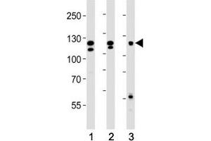 Western blot analysis of lysate from (1) HeLa, (2) K562 and (3) MCF-7 cell line using FGFR2 antibody at 1:1000.