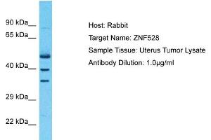 Host: Rabbit Target Name: ZNF528 Sample Type: Uterus Tumor lysates Antibody Dilution: 1. (ZNF528 抗体  (Middle Region))