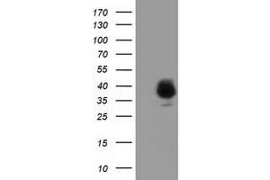 Western Blotting (WB) image for anti-Family with Sequence Similarity 84, Member B (FAM84B) antibody (ABIN1498215) (FAM84B 抗体)
