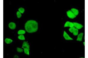 Detection of TNPO1 in Hela cells using Polyclonal Antibody to Transportin 1 (TNPO1) (Transportin 1 抗体  (AA 593-836))