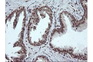 Image no. 11 for anti-Fetal and Adult Testis Expressed 1 (FATE1) antibody (ABIN1498222)
