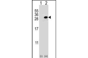 Western blot analysis of CLTA (arrow) using rabbit polyclonal CLTA Antibody (Center) (ABIN652956 and ABIN2842611). (CLTA 抗体  (AA 99-127))