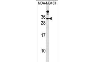 LIN7A Antibody (C-term) (ABIN1536800 and ABIN2848886) western blot analysis in MDA-M cell line lysates (35 μg/lane). (LIN7A 抗体  (C-Term))