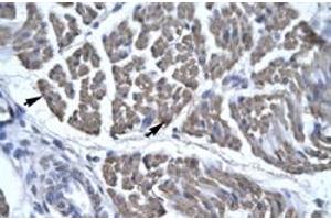 Immunohistochemical staining (Formalin-fixed paraffin-embedded sections) of human skeletal muscle with EYA3 polyclonal antibody  at 4-8 ug/mL working concentration. (EYA3 抗体  (Internal Region))