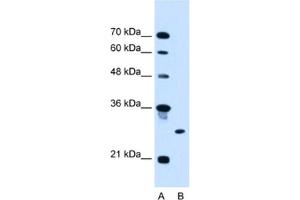 Western Blotting (WB) image for anti-Ring Finger Protein 39 (RNF39) antibody (ABIN2462699) (RNF39 抗体)