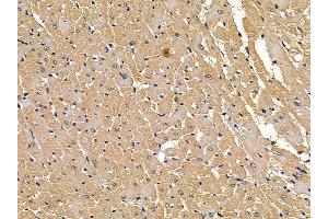 LRP6 Mouse Monoclonal Antibody at 1/100 staining rat heart tissue by IHC-P. (LRP6 抗体  (C-Term))