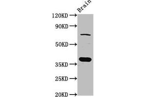 Western Blot Positive WB detected in: Rat brain tissue All lanes: SCAMP1 antibody at 4 μg/mL Secondary Goat polyclonal to rabbit IgG at 1/50000 dilution Predicted band size: 38, 19 kDa Observed band size: 38 kDa (SCAMP1 抗体  (AA 2-134))