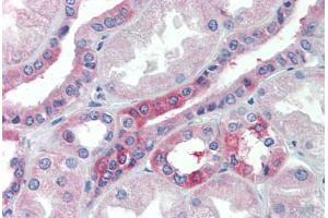 Human Kidney (formalin-fixed, paraffin-embedded) stained with SLC25A28 antibody ABIN462242 followed by biotinylated goat anti-rabbit IgG secondary antibody ABIN481713, alkaline phosphatase-streptavidin and chromogen. (SLC25A28 抗体  (AA 290-339))