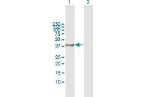 Western Blot analysis of STK19 expression in transfected 293T cell line by STK19 MaxPab polyclonal antibody. (STK19 抗体  (AA 1-364))