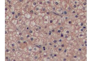 Immunohistochemistry (IHC) image for anti-Glutathione S-Transferase pi 1 (GSTP1) (AA 1-210) antibody (ABIN7433147)