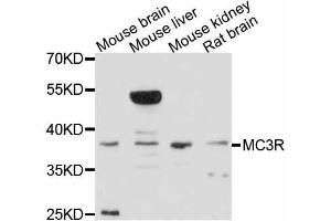 Western blot analysis of extracts of various cell lines, using MC3R antibody. (MC3R 抗体)