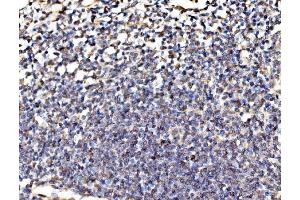 IHC analysis of Kinectin 1/KTN1 using anti-Kinectin 1/KTN1 antibody (ABIN7601096).
