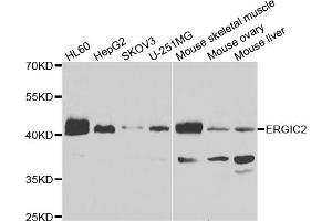 Western blot analysis of extracts of various cell lines, using ERGIC2 antibody (ABIN4903602) at 1:1000 dilution. (ERGIC2 抗体)