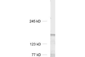 dilution: 1 : 1000, sample: rat brain homogenate (LRRC7 抗体  (AA 877-891, AA 1341-1357))