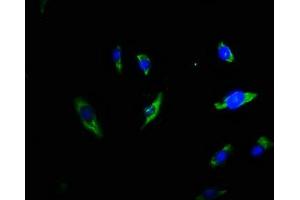 Immunofluorescence staining of U251 cells with ABIN7173353 at 1:66, counter-stained with DAPI. (Triadin 抗体  (AA 75-161))