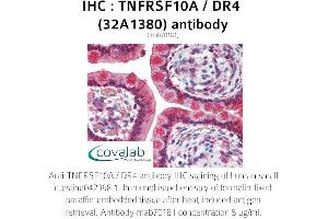 Image no. 1 for anti-Tumor Necrosis Factor Receptor Superfamily, Member 10a (TNFRSF10A) antibody (ABIN5693548)