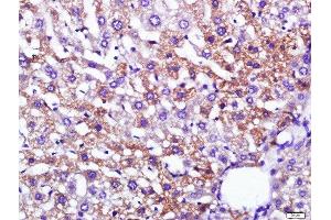 Paraformaldehyde-fixed, paraffin embedded mouse liver, Antigen retrieval by boiling in sodium citrate buffer (pH6) for 15min, Block endogenous peroxidase by 3% hydrogen peroxide for 30 minutes, Blocking buffer (normal goat serum) at 37°C for 20min, Antibody incubation with 	Leptin Polyclonal Antibody, Unconjugated  at 1:200 overnight at 4°C, followed by a conjugated secondary and DAB staining. (Leptin 抗体  (AA 101-154))