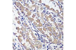 Immunohistochemistry of paraffin-embedded human stomach using UBL3 antibody (ABIN6131930, ABIN6149849, ABIN6149850 and ABIN6220468) at dilution of 1:100 (40x lens). (UBL3 抗体  (AA 1-117))