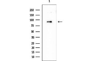 Western blot analysis of lysates from EC304 cells, using ATP6V0A4 Mouse Monoclonal Antibody at 1/1000 dilution.