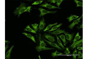 Immunofluorescence of purified MaxPab antibody to RARS on HeLa cell. (RARS 抗体  (AA 1-660))