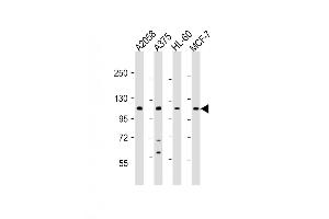 Western Blot at 1:2000 dilution Lane 1: A2058 whole cell lysate Lane 2: A375 whole cell lysate Lane 3: HL-60 whole cell lysate Lane 4: MCF-7 whole cell lysate Lysates/proteins at 20 ug per lane. (COL17A1 抗体  (AA 475-504))