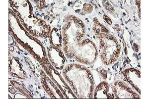 Image no. 3 for anti-Tubulin beta 4a (TUBB4A) antibody (ABIN1501580) (TUBB4 抗体)