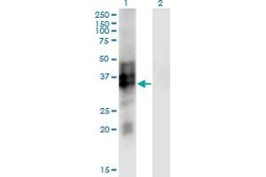 Western Blot analysis of SYP expression in transfected 293T cell line by SYP monoclonal antibody (M01), clone 3B3. (Synaptophysin 抗体  (AA 1-313))