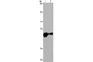 Gel: 6 % SDS-PAGE, Lysate: 40 μg, Lane 1-2: Mouse liver tissue, HepG2 cells, Primary antibody: ABIN7189742(AHRR Antibody) at dilution 1/430, Secondary antibody: Goat anti rabbit IgG at 1/8000 dilution, Exposure time: 2 minutes (AHRR 抗体)