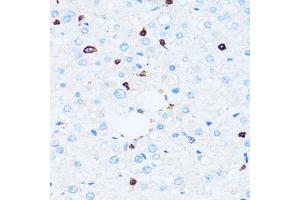 Immunohistochemistry of paraffin-embedded human liver using SPN antibody (ABIN5973813) at dilution of 1/100 (40x lens). (CD43 抗体)